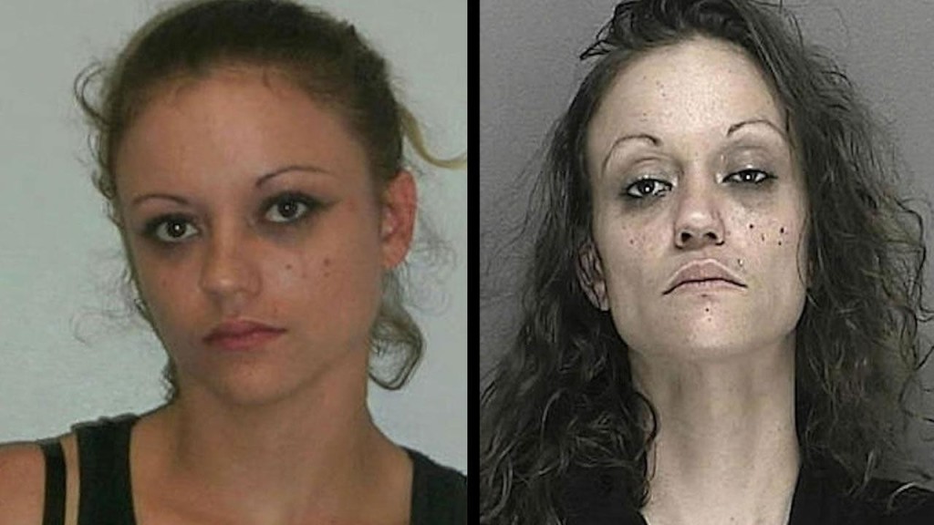 18 Disturbing Before And After Pictures Of Faces Transformed By Drug Abuse Lifecrust